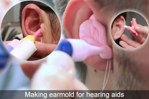 Making ear impressions for hearing aids