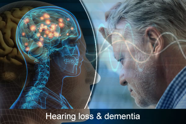 Hearing loss may cause Alzheimer's?