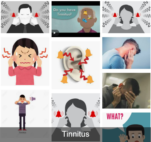 tinnitus