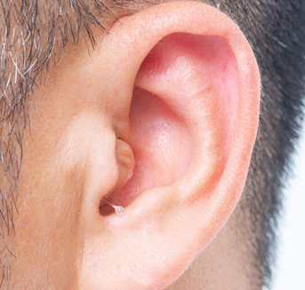 Cadenza T29 10 channels CIC Hearing Aids