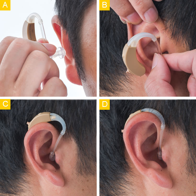 Cadenza S analog BTE hearing aids, classic class-d circuit